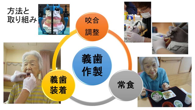 方法と取り組み 義歯の作成