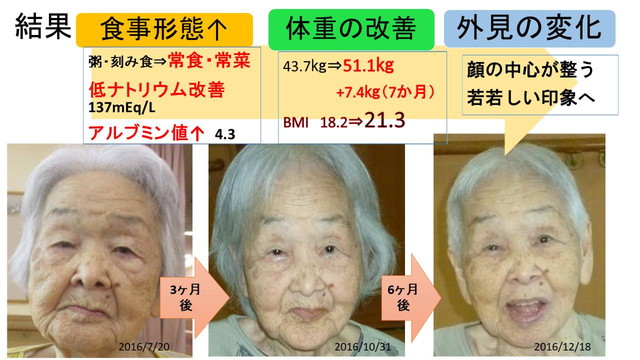 A氏の取り組みの結果 若々しい印象に