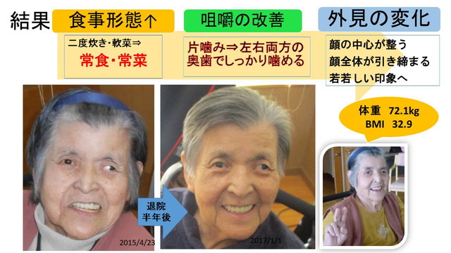 B氏の取り組みの結果 若々しい印象に